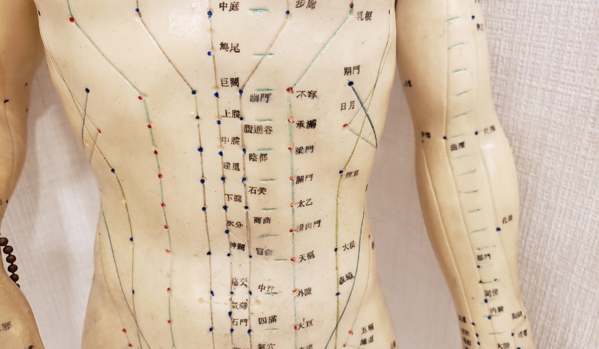 Trigger Points דיקור